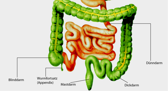 Appendicite, Inflammation de l`appendice