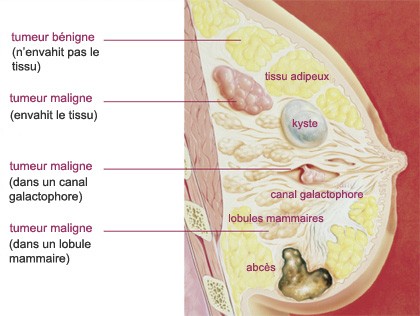 Agrandissement de l’image avec légende