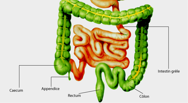 Occlusion intestinale, Iléus