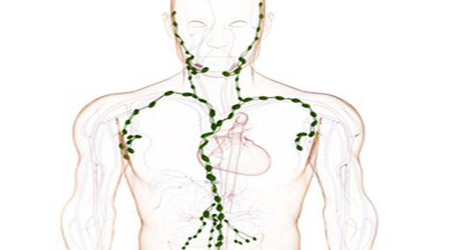 Lymphangite, Inflammation des vaisseaux lymphatiques